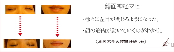 �����s���̊�ʃ}�q