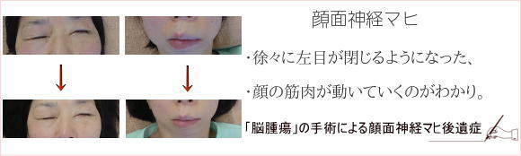 ��ʃ}�q�Ǘ�